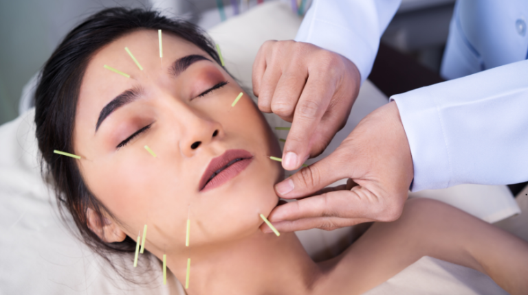 What Is Acupuncture Geometry Worksheet Answers